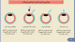 قالب پاورپوینت چشم پزشکی - تصویر 10