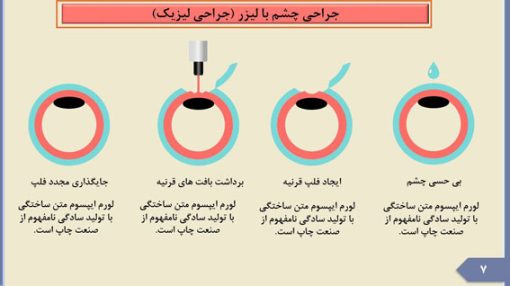 قالب پاورپوینت چشم پزشکی - تصویر 10