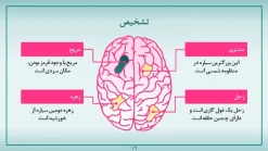 قالب پاورپوینت بیماری مغز - تصویر 13