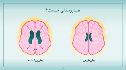 قالب پاورپوینت بیماری مغز - تصویر 9